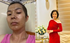 Phát hiện ung thư giai đoạn 3 đã di căn, 1 năm sau làm được điều không ai nghĩ tới: Tất cả nhờ vào 2 việc