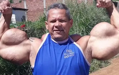 "Quái vật thể hình" Brazil sở hữu chu vi bắp tay lên tới 74cm đột ngột qua đời, bác sĩ cảnh báo 1 vấn đề sức khỏe tiềm ẩn