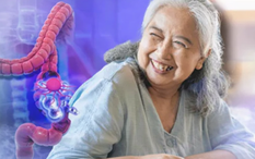 Mẹ chồng tôi bị ung thư trực tràng vì 1 thói quen tiết kiệm tưởng vô hại nhưng 30 năm sau bệnh không tái phát nhờ 3 thay đổi quan trọng