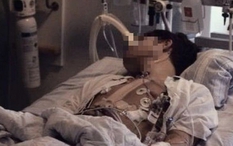 Nam sinh 18 tuổi tử vong vì ung thư đại trực tràng, bác sĩ: Nguyên nhân là món thịt thơm lừng, trẻ em Việt rất thích