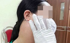 Ung thư từ cổ lan xuống gan sau 3 năm bỏ điều trị để làm 1 việc