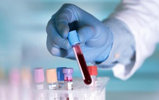 Mỹ phát triển xét nghiệm ung thư giá rẻ