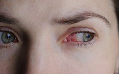 Chàng trai 24 tuổi mù đột ngột: Bác sĩ cảnh báo về thói quen mà nhiều người trẻ đang mắc mỗi tuần