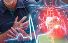 Nhóm tuổi có thể bị nhồi máu cơ tim, đột quỵ cao gấp 5 lần so với tuổi 50: Bác sĩ BV Bạch Mai cảnh báo