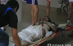 Tin đặc biệt vụ nổ kinh hoàng: Nhiều nạn nhân nhập viện bỏng