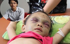 Bé 4 tuổi bị hành hạ dã man: Khi nào thì khởi tố tội Giết người?