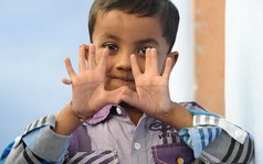 Những người có chân tay đặc biệt nhất quả đất