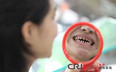 Chi gần 40 triệu để có hàm răng... quái vật