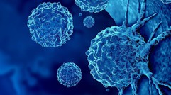 Loại ung thư đứng thứ 2 về tỉ lệ tử vong tại Việt Nam: 5 dấu hiệu sớm nhất ai cũng nên biết