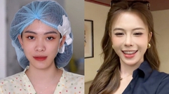 Hà Môi “đắp tiền lên mặt” để sửa những gì? Còn chiếc mũi “đang hếch dần và méo” giờ ra sao?