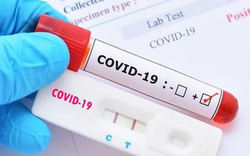 NÓNG:  83% mẫu COVID-19 tại TP HCM là biến chủng mới NB.1.8.1