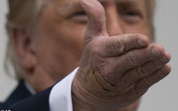 Bức ảnh tiết lộ dấu hiệu lạ trên bàn tay ông Trump