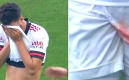 Hy hữu: Cầu thủ Brazil gặp chấn thương "kinh hoàng" nhất đối với nam giới