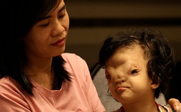 Mẹ của cô bé có khuôn mặt biến dạng ở Quảng Bình gửi con để đi giúp người dân chống lũ