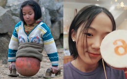 "Cô bé bóng rổ" bị cắt bỏ toàn bộ phần thân dưới khiến hàng triệu người quặn lòng năm xưa giờ sống thế nào?