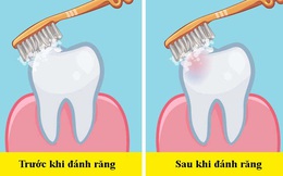 Các nha sĩ trả lời câu hỏi "dễ mà khó": Nên đánh răng trước hay sau bữa ăn sáng?