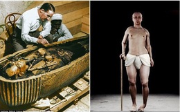 Chuyên gia chụp 2000 tấm ảnh X-quang, tái hiện dung mạo Pharaoh Tutankhamun - Răng và bàn chân đều có vấn đề