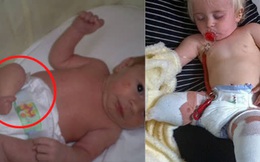 Bé gái sinh ra với đôi chân chỉ dài 5cm, 18 tháng tuổi đã phải cưa cụt chân để giữ mạng sống 10 năm trước gây ngỡ ngàng với cuộc sống hiện tại