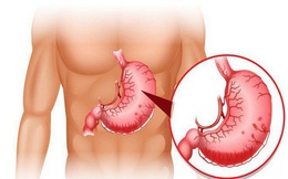 6 bệnh dễ mắc ở nam giới tuổi trung niên