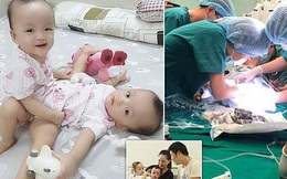 Ca phẫu thuật tách rời thành công cặp song sinh Trúc Nhi - Diệu Nhi của các y bác sĩ Việt Nam thu hút sự chú ý báo chí nước ngoài