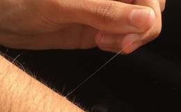 Tại sao một số lông trên cơ thể bạn có thể mọc dài tới mức vô lý