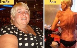 Người phụ nữ từng nặng 130 kg gây sốc với thân hình gầy trơ xương ám ảnh sau phẫu thuật thắt dạ dày để giảm cân