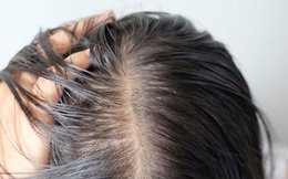 7 lý do bạn không nên đi ngủ khi tóc ướt