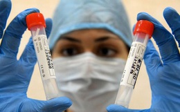 Nga sẽ bắt đầu sản xuất vaccine ngừa Covid-19 vào tháng 11