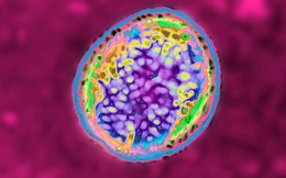 Nhà máy vaccine TQ dùng đồ hết hạn sử dụng: Hàng nghìn người đổ bệnh vì hít phải vi khuẩn rò rỉ