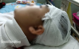 Nam sinh lớp 11 bị bạn cùng trường dùng gậy sắt đánh vỡ sọ não?