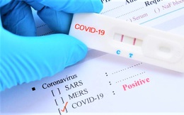 Bộ Y tế đề nghị doanh nghiệp báo cáo giá bán test xét nghiệm COVID-19