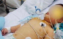 Bé trai 14 tháng tuổi tổn thương não vì gặp tai nạn thương tâm ngay tại nhà