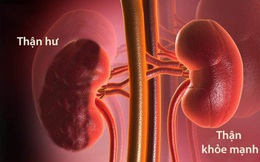 Người thận yếu thường có 6 đặc điểm rất dễ nhận biết: Hãy sớm đi khám nếu bạn có cảm giác tương tự