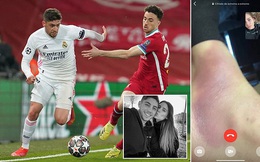 ‘Chiến binh’ của Real Madrid nén đau đá hết 90 phút