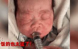 Clip: Em bé vừa sinh ra đã đói đến... hạ đường huyết, hút một hơi hết sạch ống glucose mà cô y tá cho