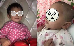 Bé gái 2 tuổi bị đầu độc bằng kẹo tẩm thuốc chuột trong đám cưới, thủ phạm là ai?