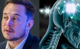 Công ty của Elon Musk chuẩn bị cấy ghép chip vào não người để "chế tạo" siêu nhân