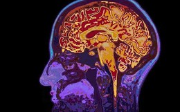 fMRI: Phương pháp 'đọc suy nghĩ' của bất kỳ ai mà chẳng cần chạm vào đầu