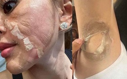 Bóc trần chiêu trò peel da như thật của 'vũ trụ hotgirl bán hàng online': Một cú lừa!