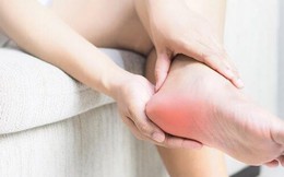 Những dấu hiệu khác thường trên bàn chân cho thấy sức khỏe của bạn đang ‘kêu cứu’