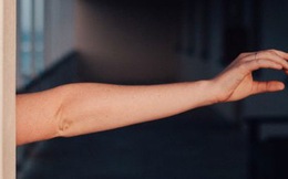 Nghiên cứu mới: Con người tiếp tục phát triển thêm một động mạch giữa trong cánh tay
