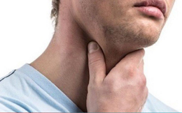 Ung thư vòm họng: Nguyên nhân, triệu chứng và cách phòng tránh