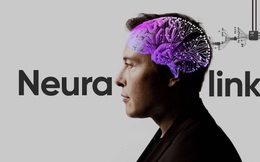 Elon Musk nói sẽ cấy chip vào não người trong năm nay, đây là những gì chúng ta biết