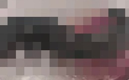 Bé gái 2 tuổi liên tục chảy máu cam, “quái vật” gắp ra từ trong mũi gây hãi hùng