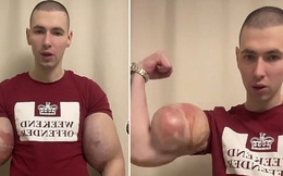 Được mệnh danh là Popeye đời thật, người đàn ông khiến dân tình hoảng sợ