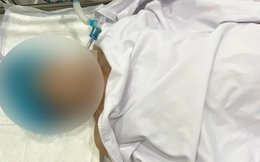 KHẨN: Bộ Y tế vào cuộc vụ người phụ nữ tử vong khi nâng ngực tại TP.HCM