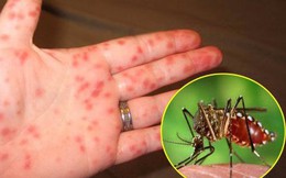 Làm sao biết chính xác sắp khỏi bệnh sốt xuất huyết?