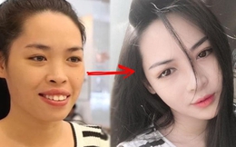 Pha đổi đời nhờ ''dao kéo'' đỉnh nhất nhì Việt Nam: Nữ chính hoá thành mỹ nhân