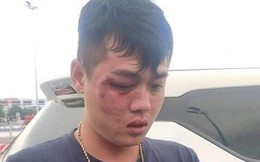 Đà Nẵng: Va chạm giao thông, nhóm người hành hung dã man tài xế ô tô grab