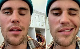 Justin Bieber rất hoảng sợ và lo lắng về tác dụng phụ của hội chứng gây liệt nửa mặt